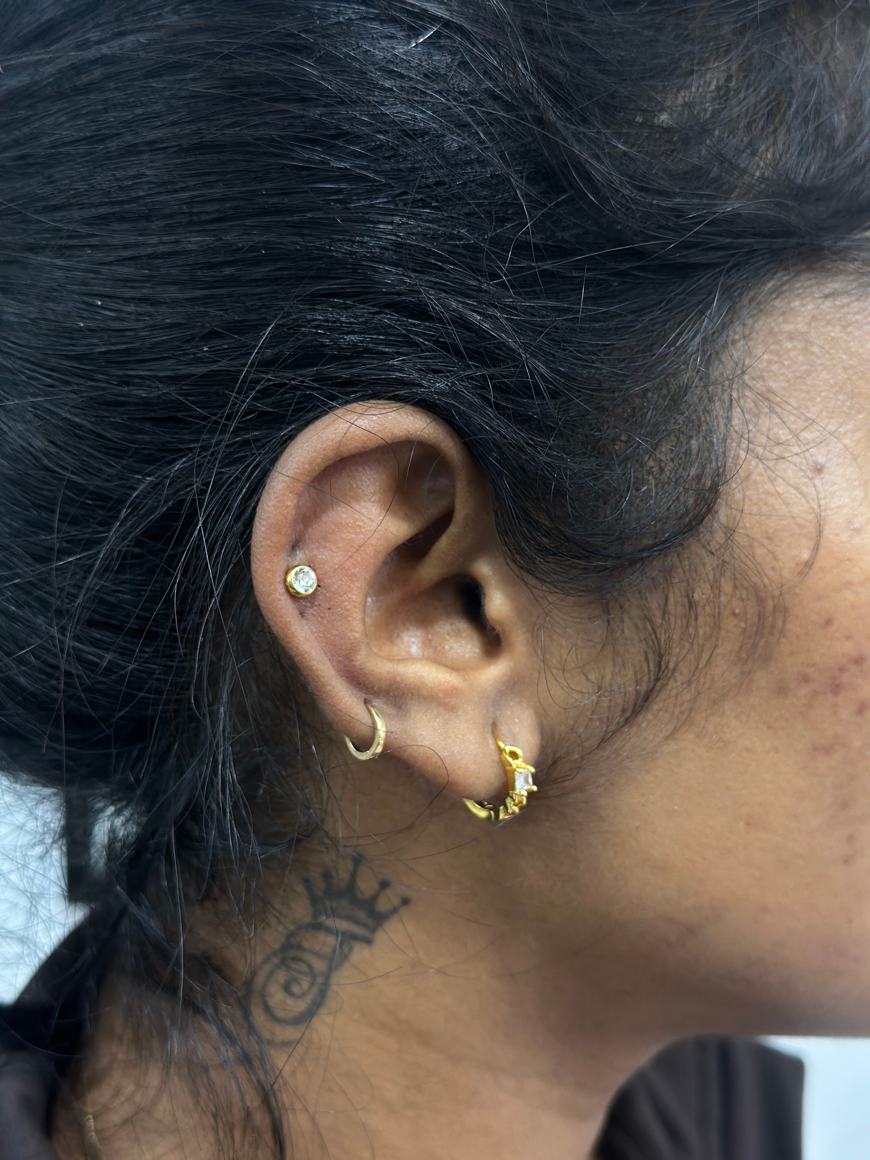 Lobe upgrade